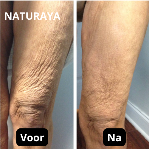 Verjongende Lichaamsolie