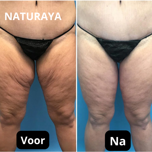 Verjongende Lichaamsolie