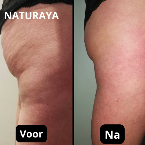 Verjongende Lichaamsolie