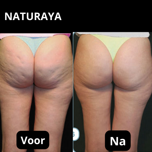 Verjongende Lichaamsolie