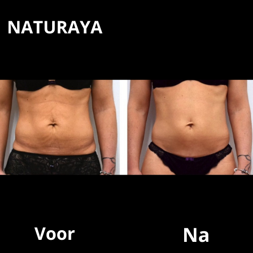 Verjongende Lichaamsolie